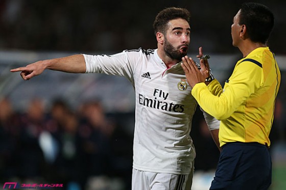 20141230_carba_getty